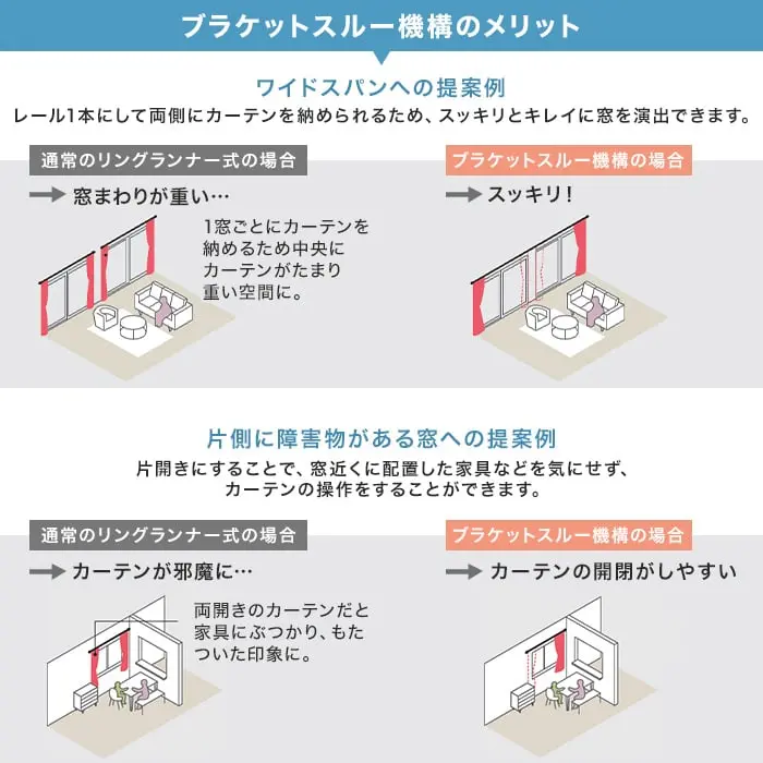 ブラケットスルー機構のメリット